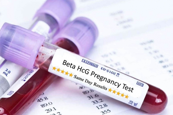Có thể xét nghiệm Beta hCG để chuẩn đoán có thai hay không
